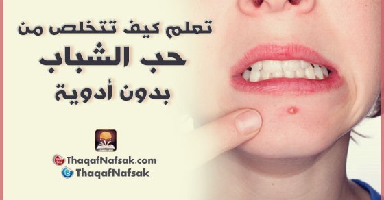 كيف تتخلص من حب الشباب بدون استخدام أدوية ؟ كيف تتخلص من حب الشباب بدون استخدام أدوية ؟