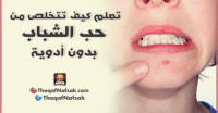 كيف تتخلص من حب الشباب بدون استخدام أدوية ؟