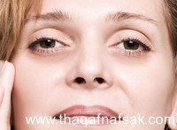 كيف تتخلصِ من انتفاخ العينين كيف تتخلصِ من انتفاخ العينين