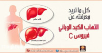 دراسة كاملة عن مرض فيروس سي الكبدي دراسة كاملة عن مرض فيروس سي الكبدي
