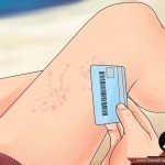 لسعة قنديل البحر كيف تتجنبها والإسعافات الأولية لها