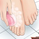 طرق علاج رائحة القدم والحذاء الكريهة