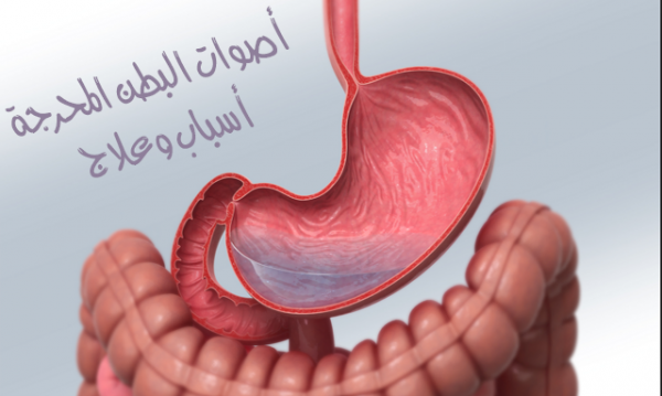 قرقرة البطن أو أصوات البطن المحرجة أسبابها وعلاجها