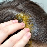 كيف استخدم الثوم لعلاج تساقط الشعر نقدم لك الطريقة بالصور و الخطوات الكاملة