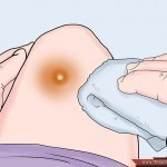 بالصور خطوات علاج الخراج في البيت بطرق طبيعية في زمن قياسي