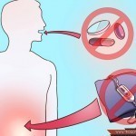 كيف أعرف إني مصاب بالزائدة ؟ هذه هي أعراض التهاب الزائدة الدودية