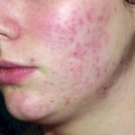 بالصور ماذا تقول ملامح وجهك عن صحتك ؟