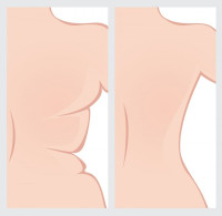 كيف اتخلص من دهون الظهر ؟ أهم النصائح والخطوات