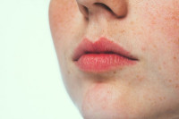 طرق التخلص من النمش إليكم علاج النمش مع ١٠ خلطات منزلية سهلة طرق التخلص من النمش إليكم علاج النمش مع ١٠ خلطات منزلية سهلة