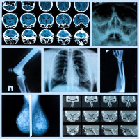 كيف تحافظ على صحة عظامك لتتجنب هشاشة العظام وأمراض العظام الأخرى