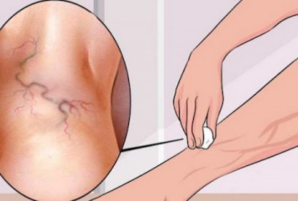 وداعاً للدوالي عند وضع قدميك في هذا الزيت وداعاً للدوالي عند وضع قدميك في هذا الزيت