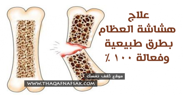 علاج هشاشة العظام بشكل طبيعي وأمن