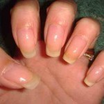 بالصور رسم مانيكير الأظافر على شكل كروت الكوتشينة