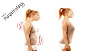 اسباب وعلاج تقوس الظهر