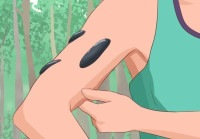 العلق الطبي استخداماته واثارة العلاجيه