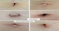 تعرف علي حقائق وأنواع سُرة البطن تعرف علي حقائق وأنواع سُرة البطن