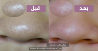 ١٠ خلطات لتضيق المسام الواسعة وتنظيفها