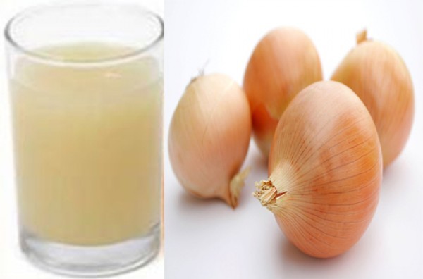 علاج القشرة بوصفة عصير البصل علاج القشرة بوصفة عصير البصل