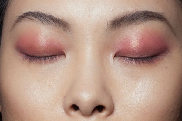 حساسية العين في الربيع الوقاية والعلاج