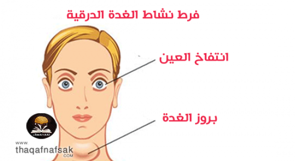 زيادة نشاط الغدة الدرقية أسباب وأعراض وعلاج طبيعي