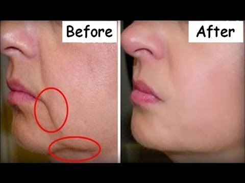 علاج التجاعيد بوصفات البيض ٢٤ خلطة