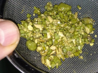 علاج حصى المرارة بوصفات طبيعية