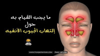 ما يجب أن تفعله لوقف إلتهاب الجيوب الأنفية