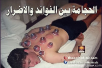 الحجامة و فوائدها للصحة و لعلاج العديد من الأمراض