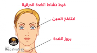 زيادة نشاط الغدة الدرقية أسباب وأعراض وعلاج طبيعي