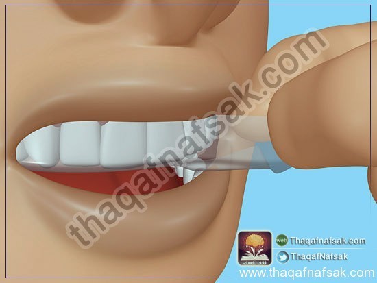 بالصور كيف تبيض أسنانك في المنزل ؟ بالصور كيف تبيض أسنانك في المنزل ؟