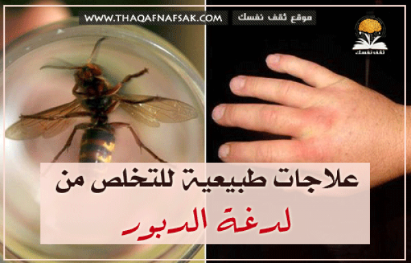 علاج لدغة الدبور بوصفات منزلية سريعة توقف الألم علاج لدغة الدبور بوصفات منزلية سريعة توقف الألم