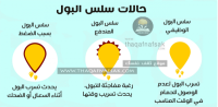 سلس البول لماذا قد تُصاب به وما علاجه ؟ سلس البول لماذا قد تُصاب به وما علاجه ؟
