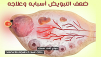 ضعف التبويض أعراضه، أسبابه وطرق علاجه فوراً حتى لا يتفاقم الوضع