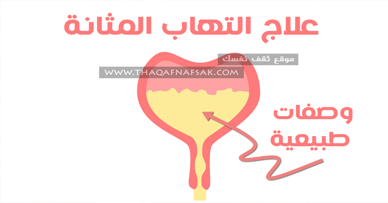 علاج التهاب المثانة بطرق طبيعية سهلة علاج التهاب المثانة بطرق طبيعية سهلة