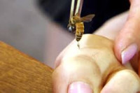 أماكن لسع النحل في الجسم أماكن لسع النحل في الجسم