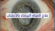 علاج المياه البيضاء بالأعشاب
