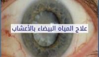 علاج المياه البيضاء بالأعشاب