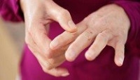 علاج الروماتيزم نهائيا علاج الروماتيزم نهائيا
