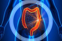 شكل البراز في القولون العصبي شكل البراز في القولون العصبي