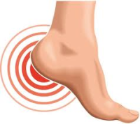اسباب وعلاج الشوكة العظمية اسباب وعلاج الشوكة العظمية