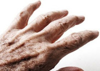 مرض الشلل الرعاش…باركنسون
