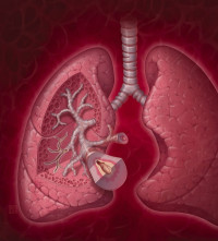 اعراض و علاج مرض الرئة الانسدادي المزمن اعراض و علاج مرض الرئة الانسدادي المزمن