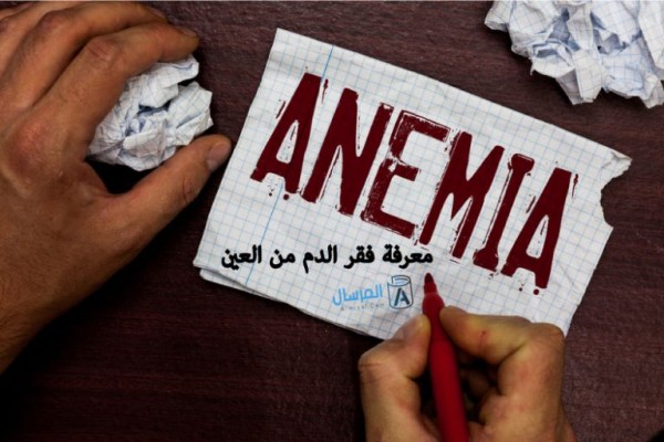 كيف اعرف فقر الدم من العين