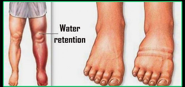كيف ازيل الماء الزائد من الجسم كيف ازيل الماء الزائد من الجسم