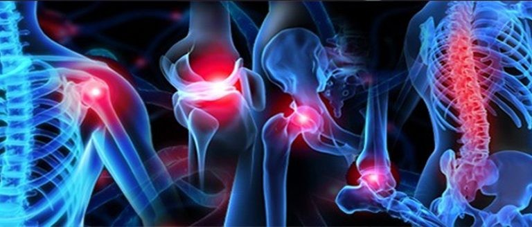 الفرق بين ألم العضلات وألم العظام الفرق بين ألم العضلات وألم العظام