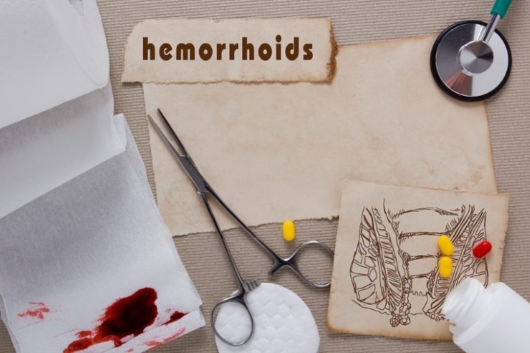 ما هي مهيجات البواسير