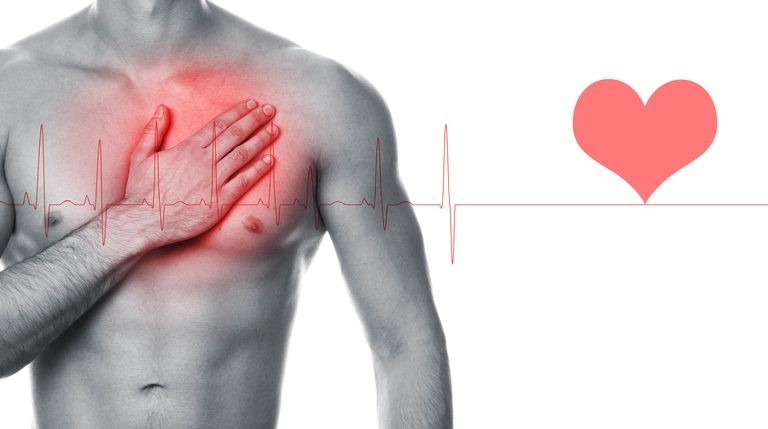 اسباب السكتة القلبية المفاجئة عند الشباب اسباب السكتة القلبية المفاجئة عند الشباب