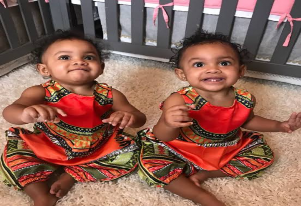 صور أنواع التوائم