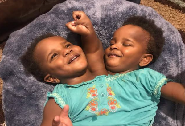 صور أنواع التوائم