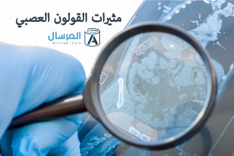 مثيرات القولون العصبي